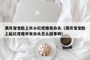 满月宝宝脸上长小红疙瘩有白头（满月宝宝脸上起红疙瘩并有白头怎么回事啊）